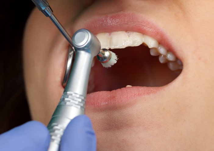 Close up of a professional dental brushing at the clinic