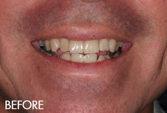 Before photograph from smile gallery example 1