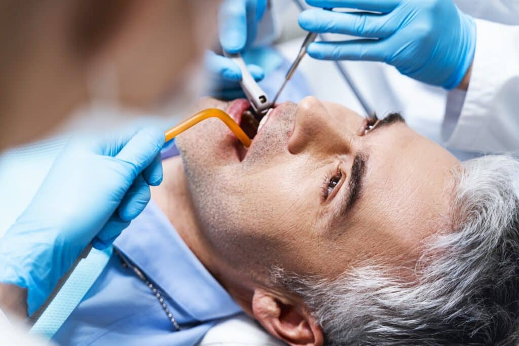 dental filling