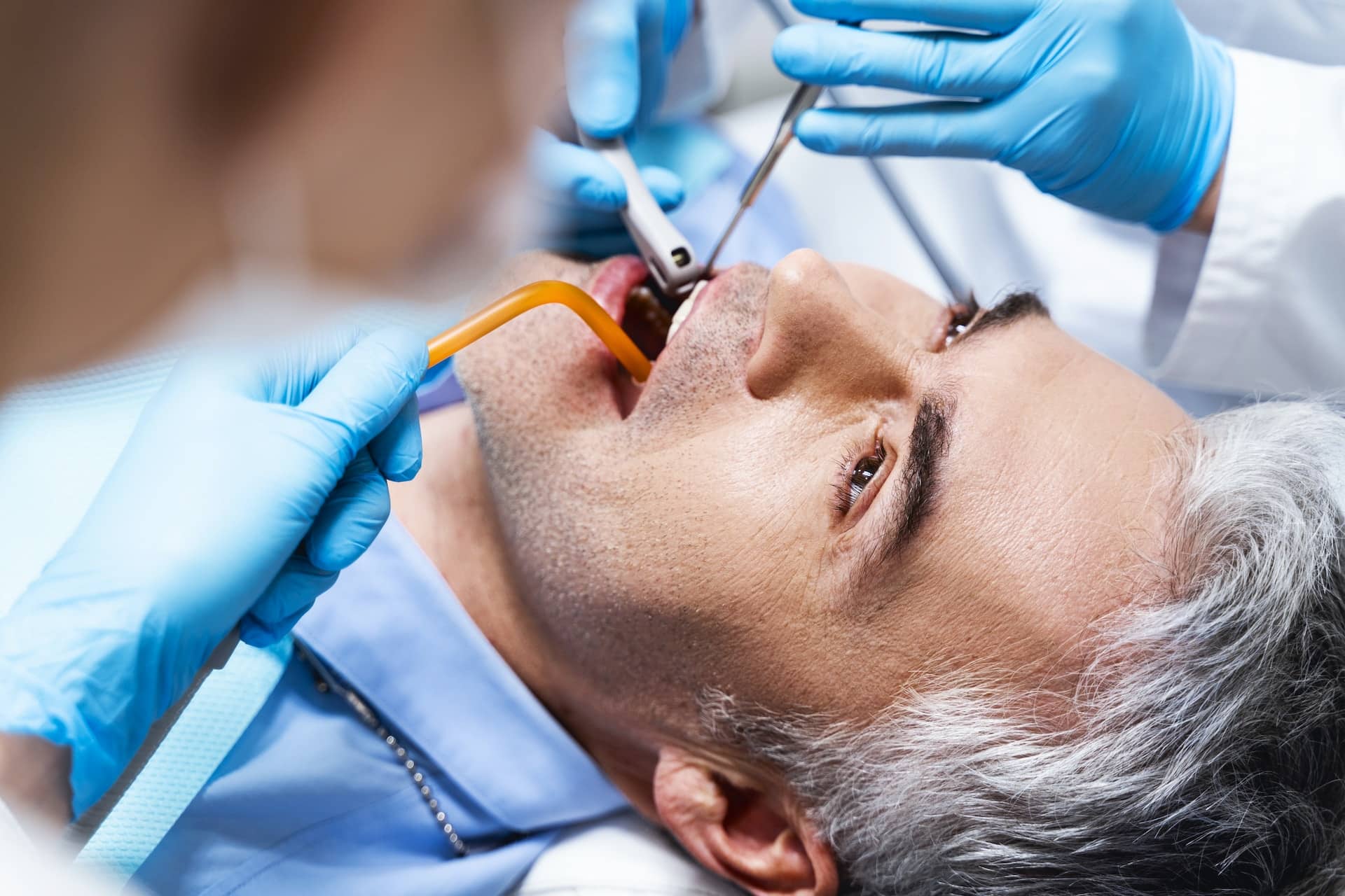 dental filling