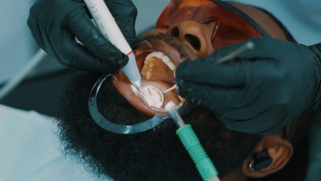 dental fillings