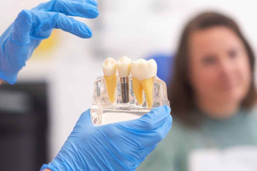 dental implant