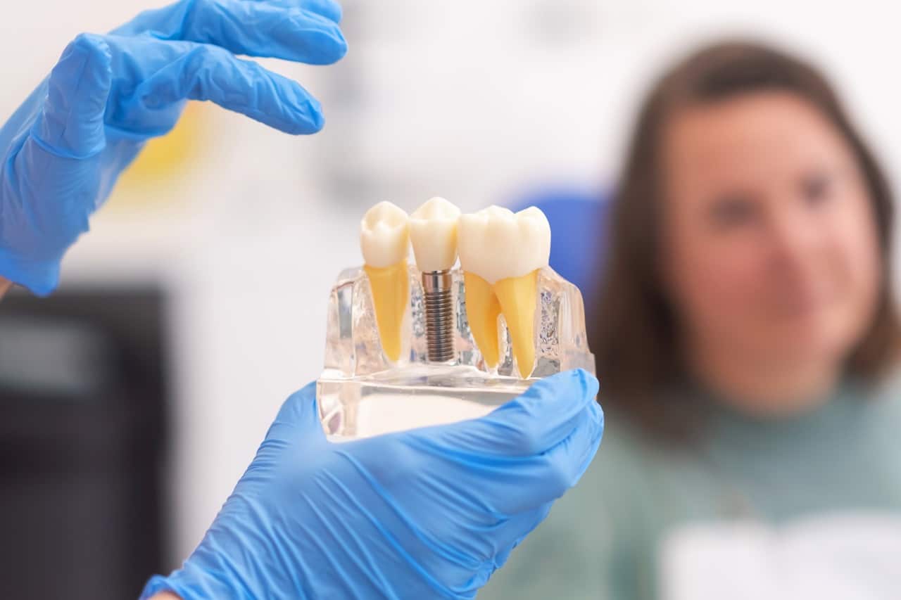 dental implant