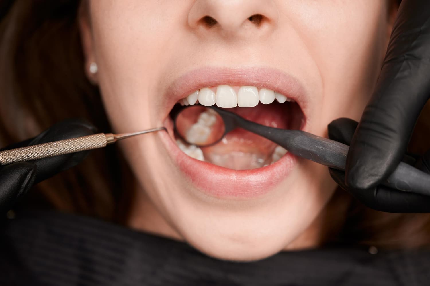 dental treatment