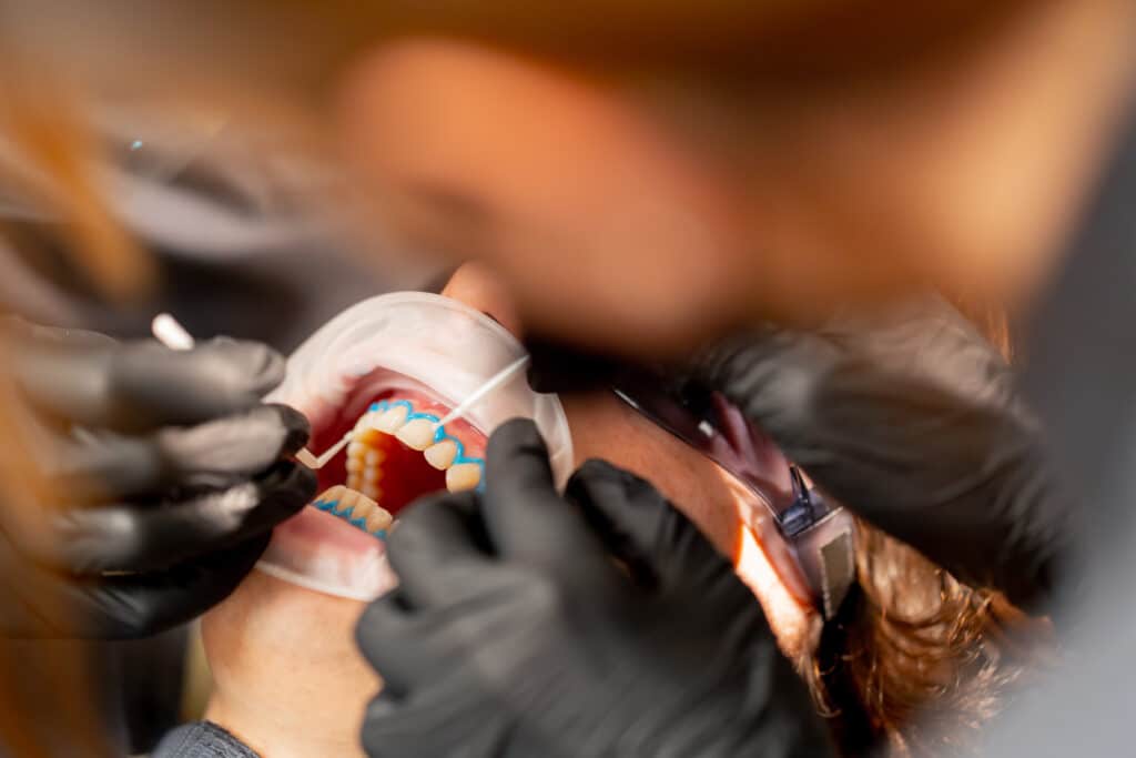 Tooth-Coloured Fillings