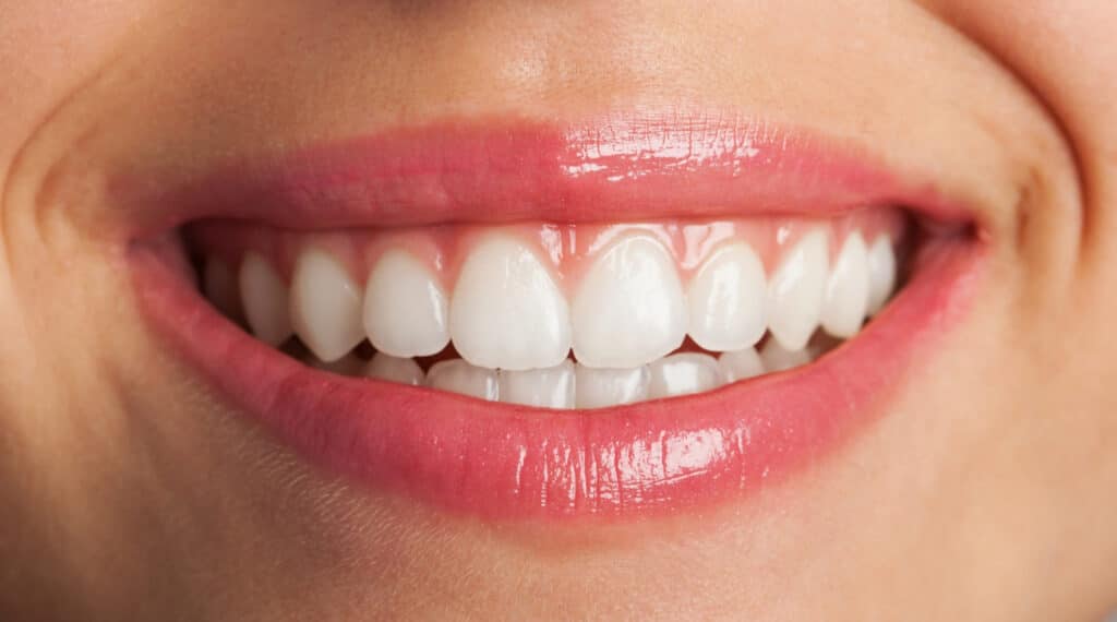 dental implant
