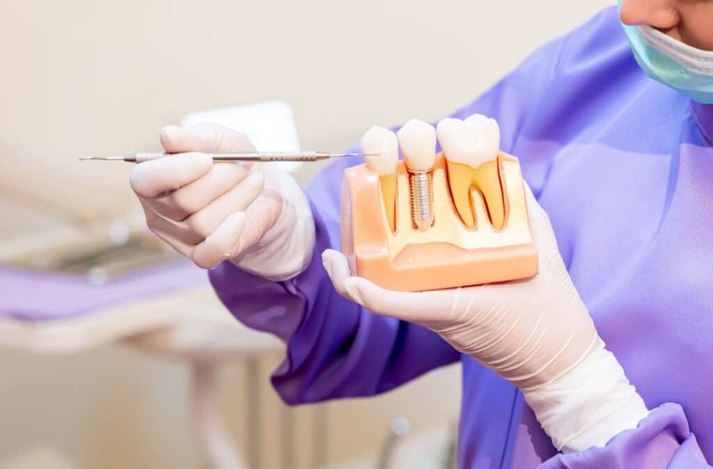 dental implant
