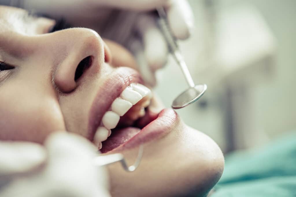 Dental Crown