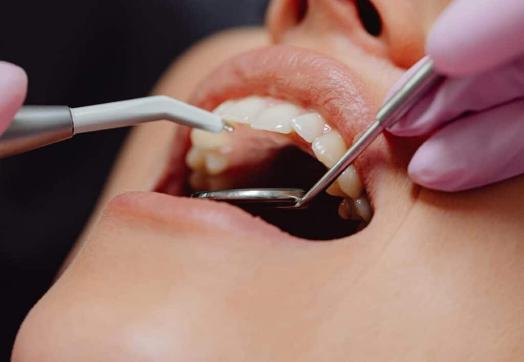 dental treatment