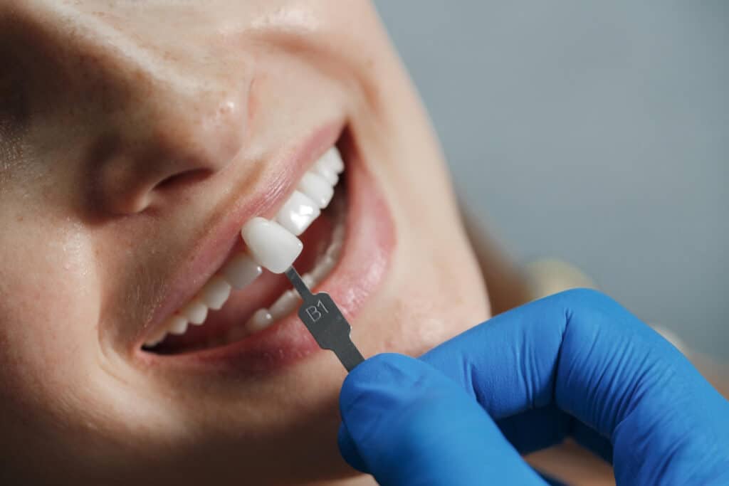 Dental Implant — Pickering, ON