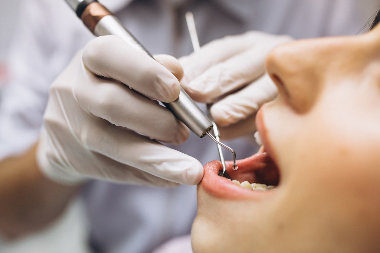 Tooth Preservation