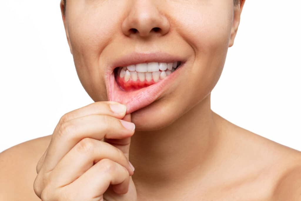 Gum Problems