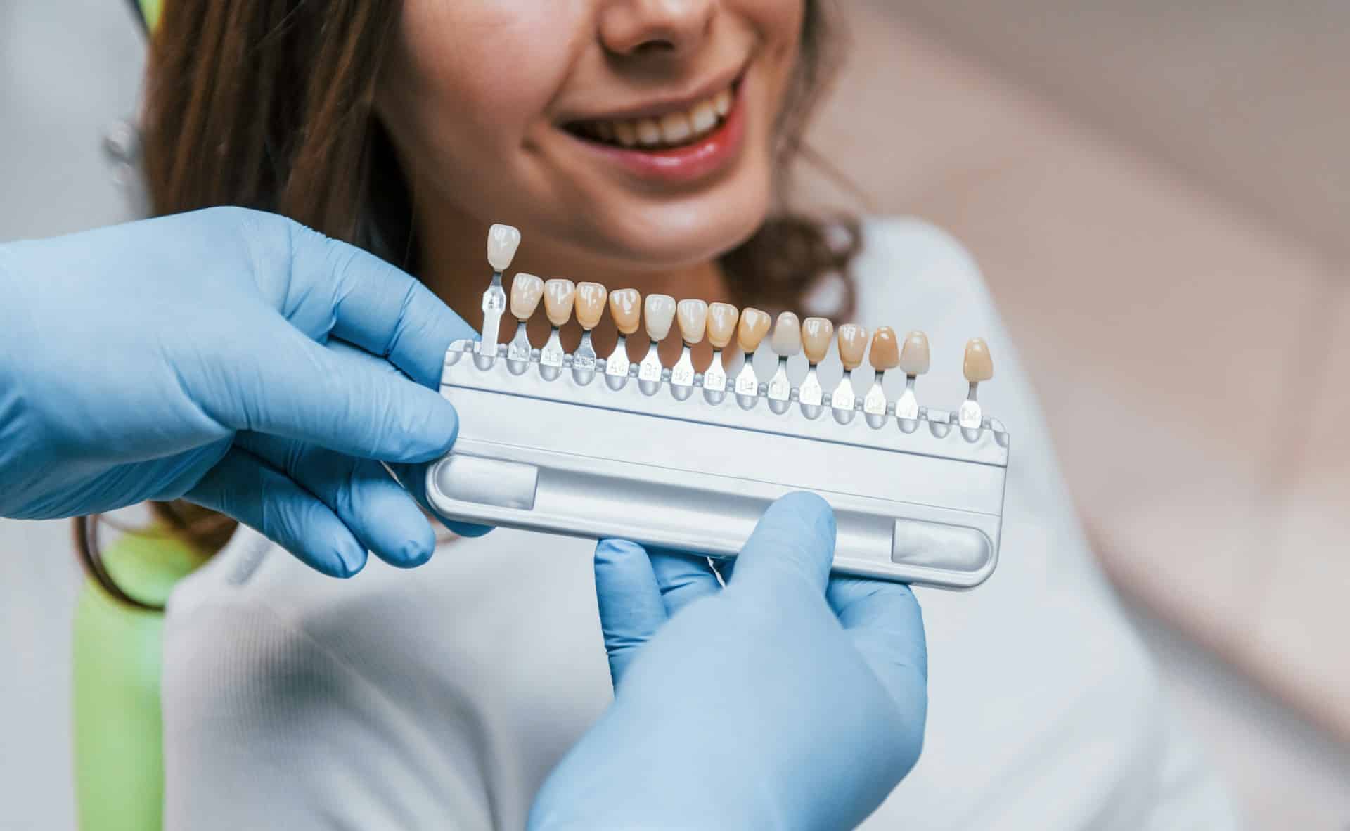 Veneers