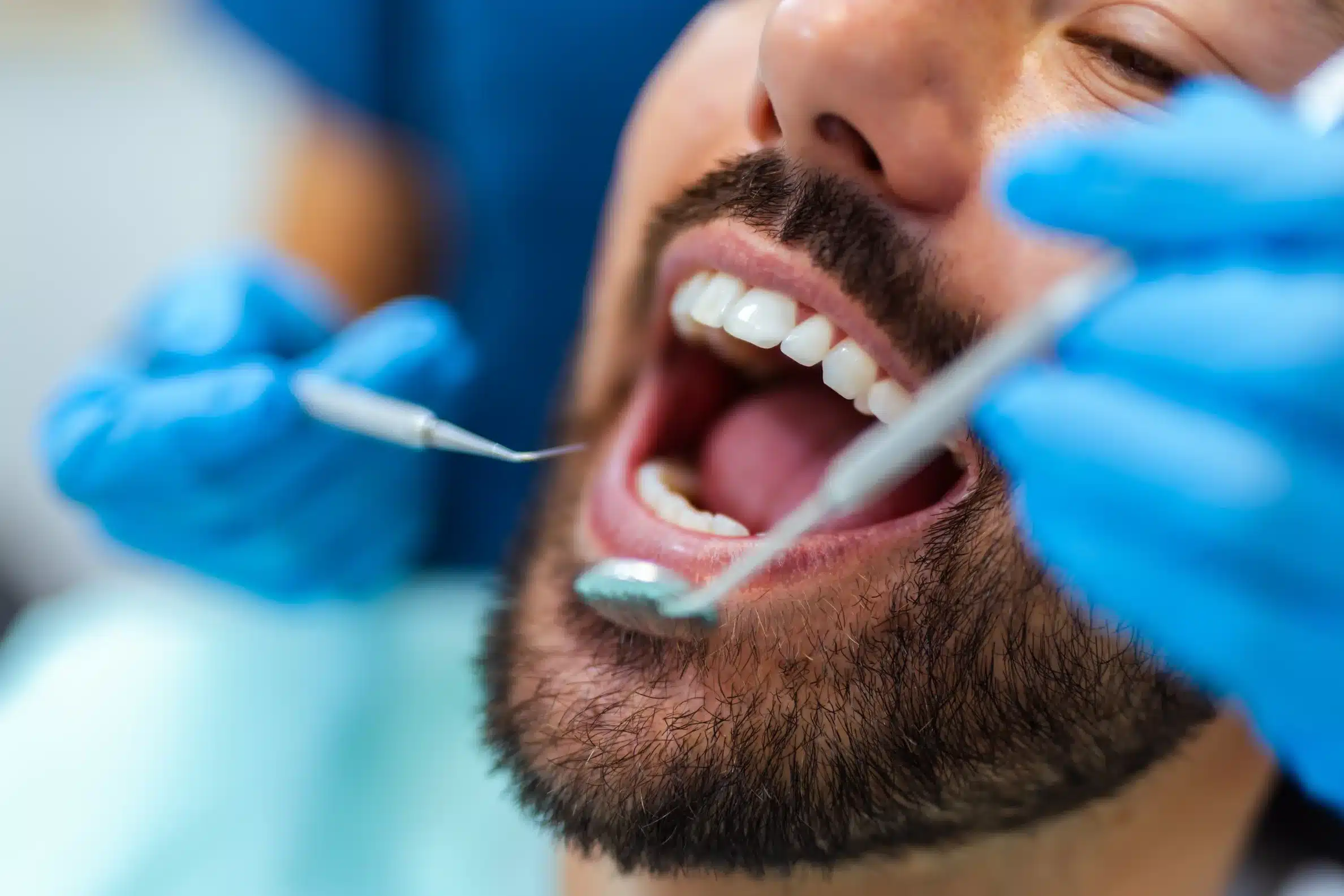 Hygiene appointment / gum assessment dental care photograph